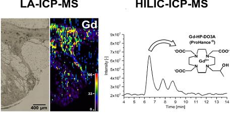 three figures showing a) Microscopic image of the investigated skin section of a NSF patient. b) LA-ICP-MS distribution map for Gd in the same skin section c) HILIC-ICP-MS chromatograms of the sample extract 